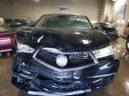 2017 Acura Mdx  იყიდება Elgin-ში, IL - Front End