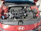 2025 Hyundai Elantra Sel Sport იყიდება Antelope-ში, CA - All Over