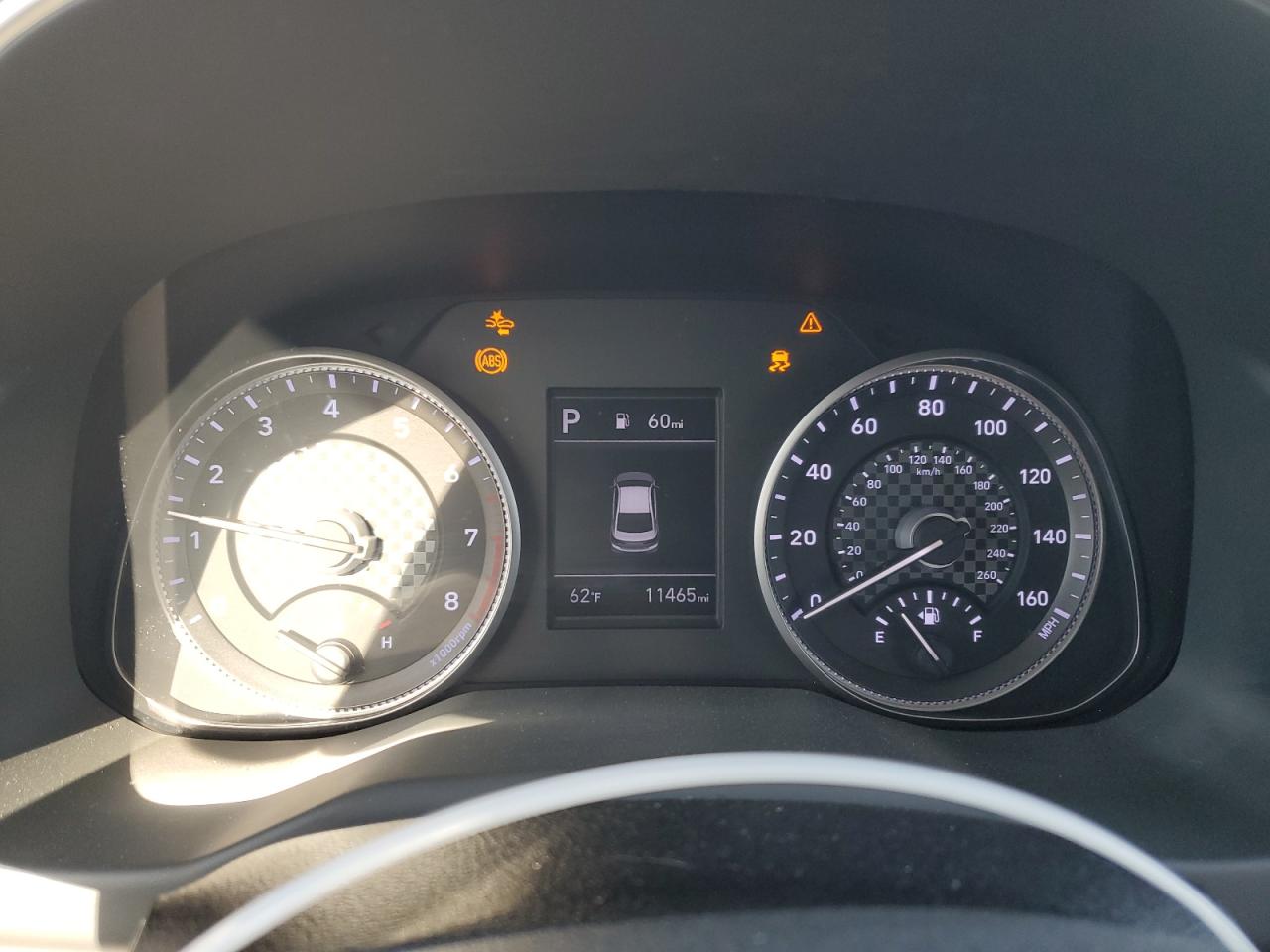 2020 Hyundai Elantra - Image 9
