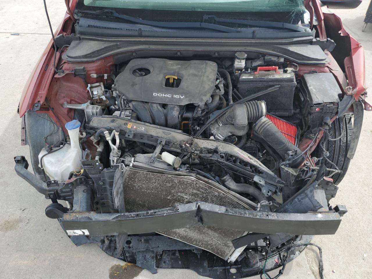 2017 Hyundai Elantra - Image 11