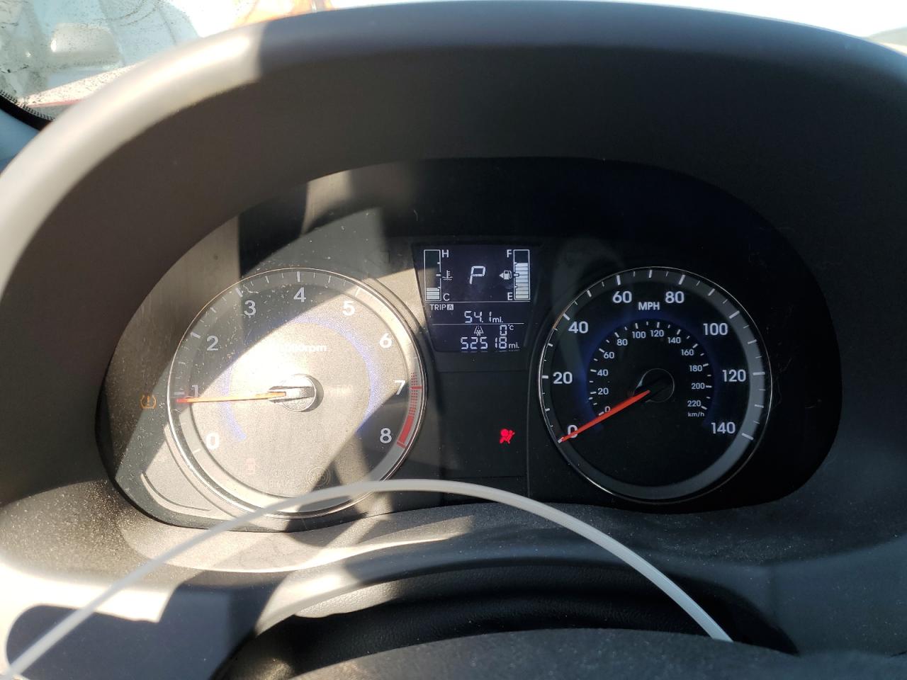 2017 Hyundai Accent - Image 9