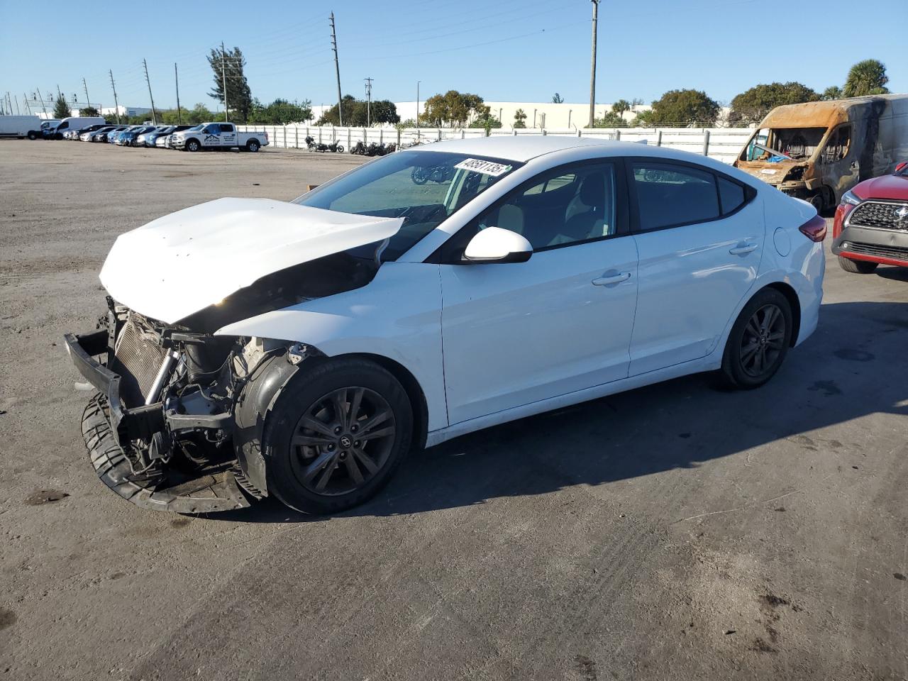 2018 Hyundai Elantra - Image 1