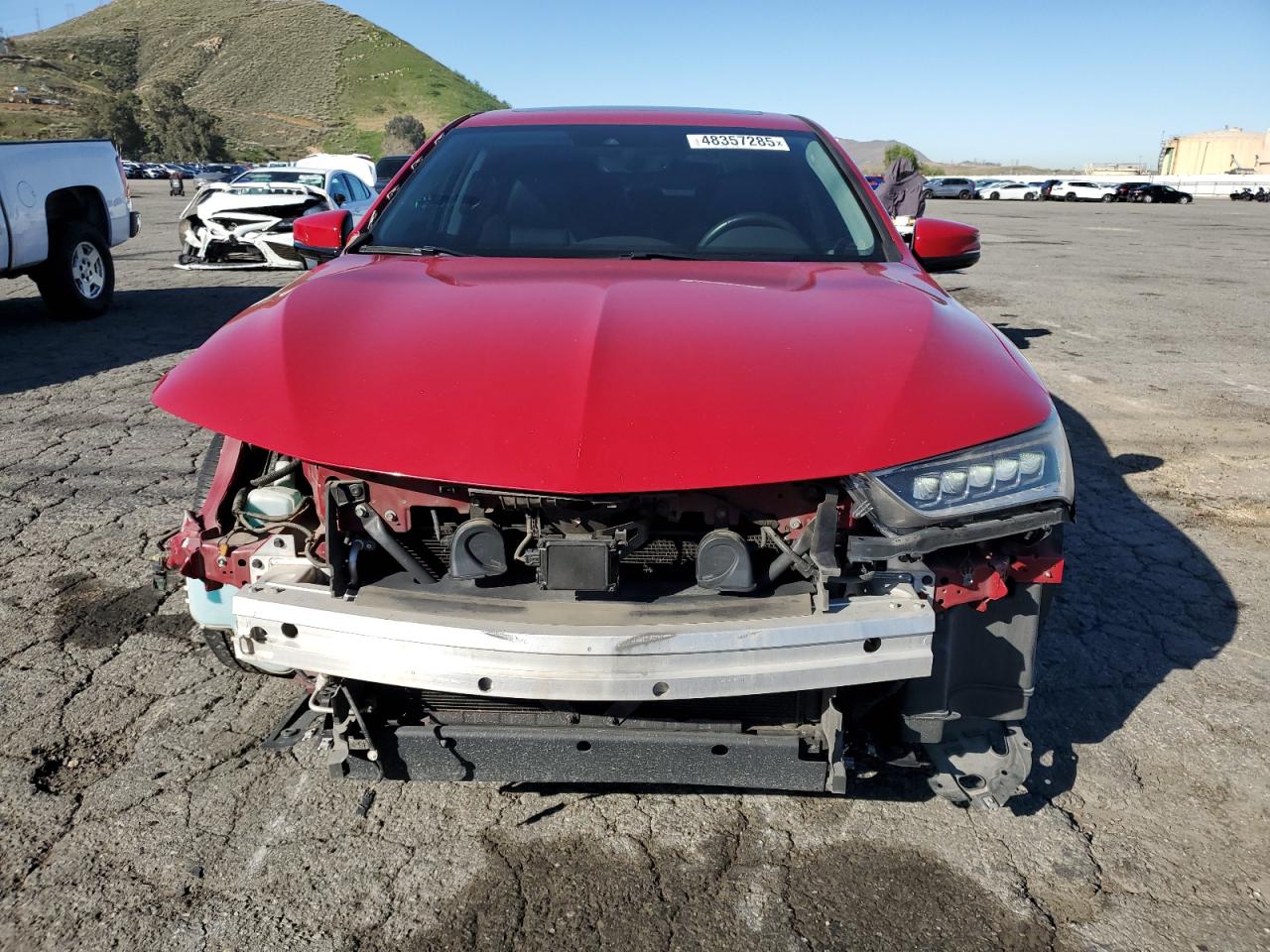 2018 Acura TLX - Image 5