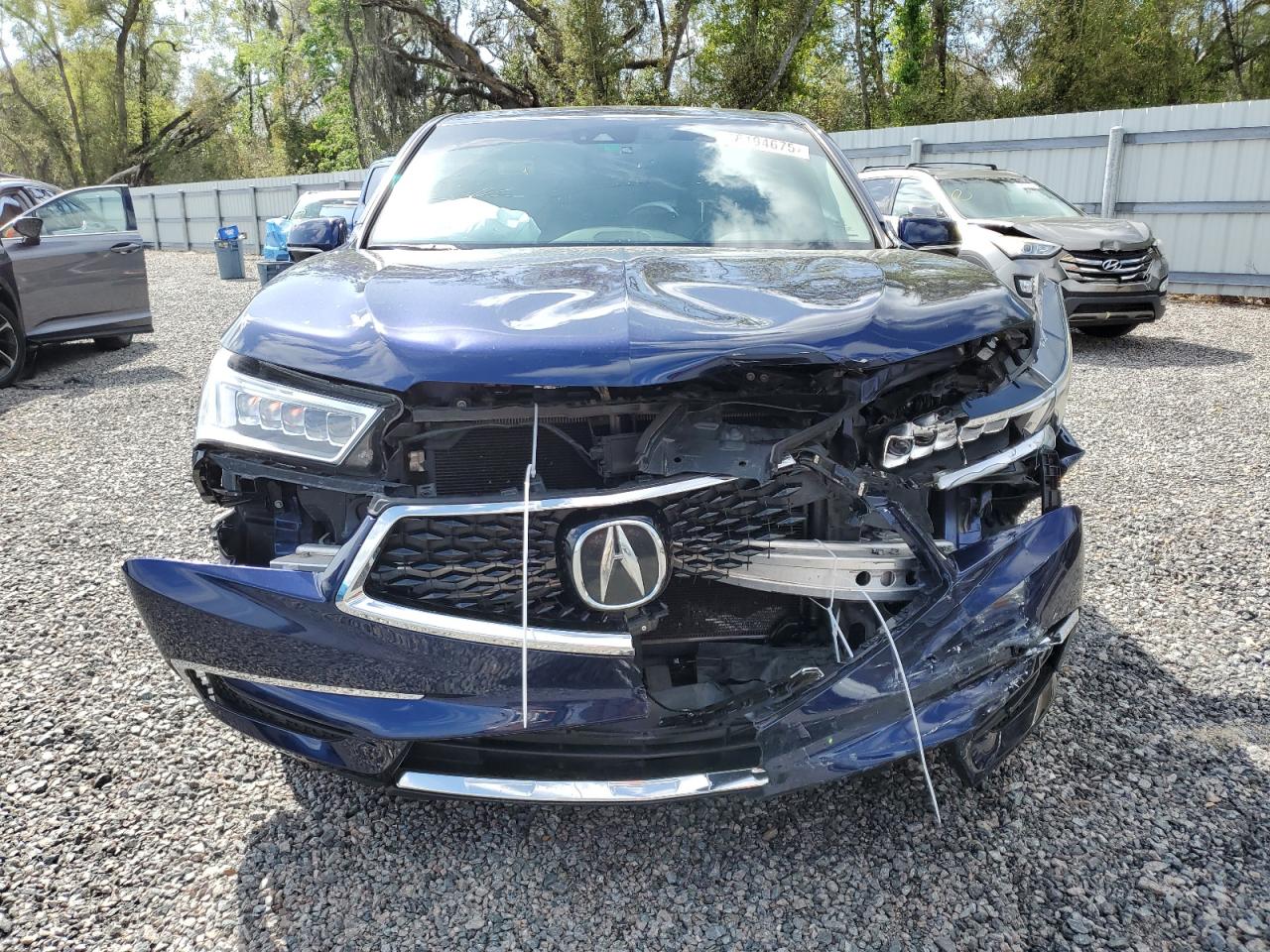 2018 Acura MDX - Image 5