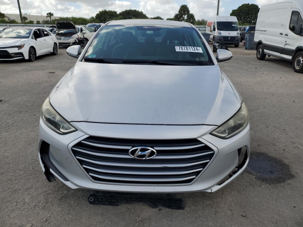 2017 Hyundai Elantra - Image 5