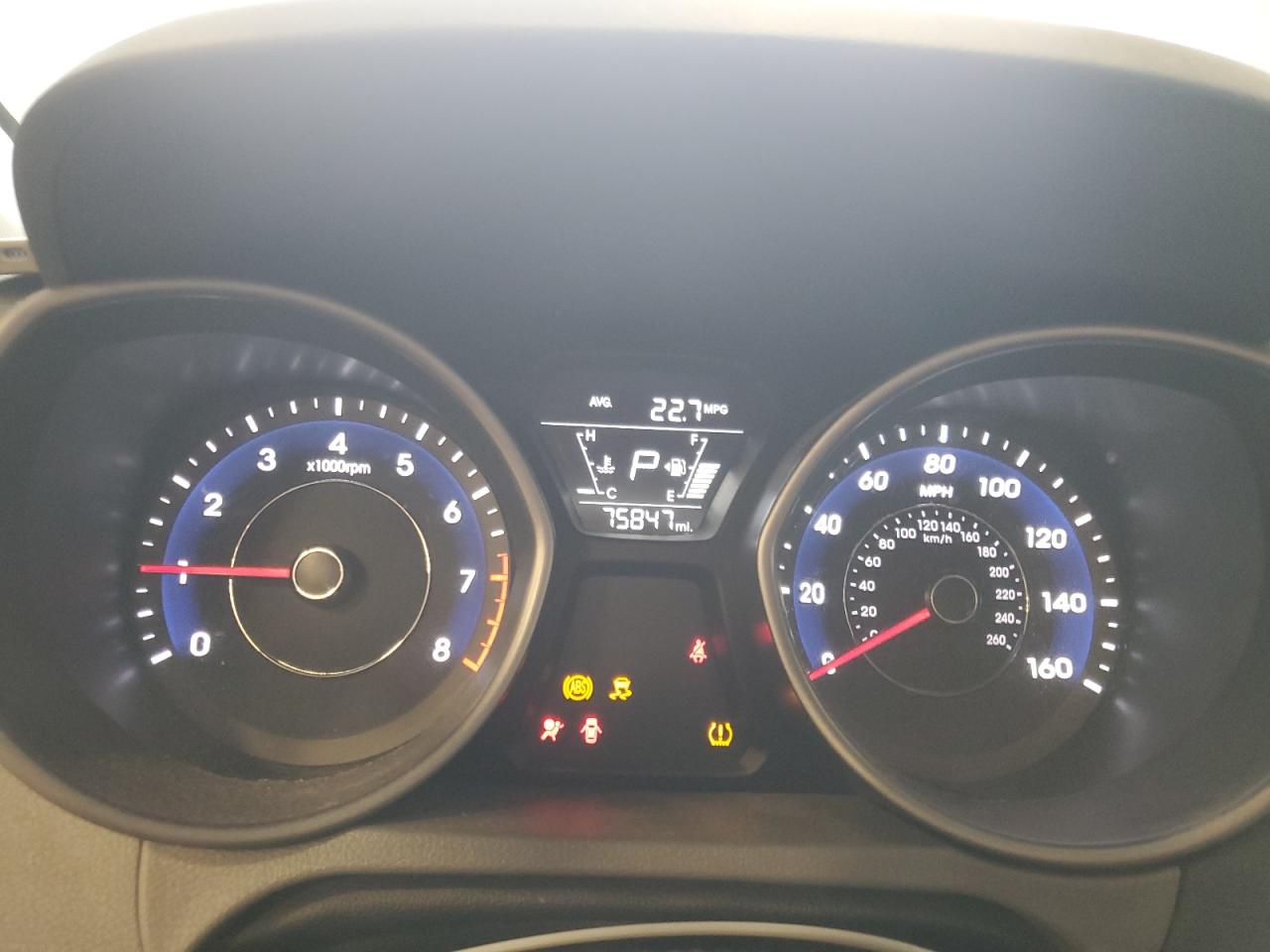 2016 Hyundai Elantra - Image 9