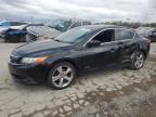 2014 Acura Ilx 20 Tech for Sale in Indianapolis, IN - Side