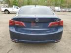Baltimore, MD에서 판매 중인 2015 Acura Tlx  - Front End