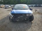 2020 Nissan Versa S for Sale in Shreveport, LA - Front End