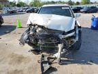2011 Acura Rdx  for Sale in Florence, MS - Front End