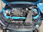 2025 Buick Envista Sport Touring for Sale in Exeter, RI - Front End