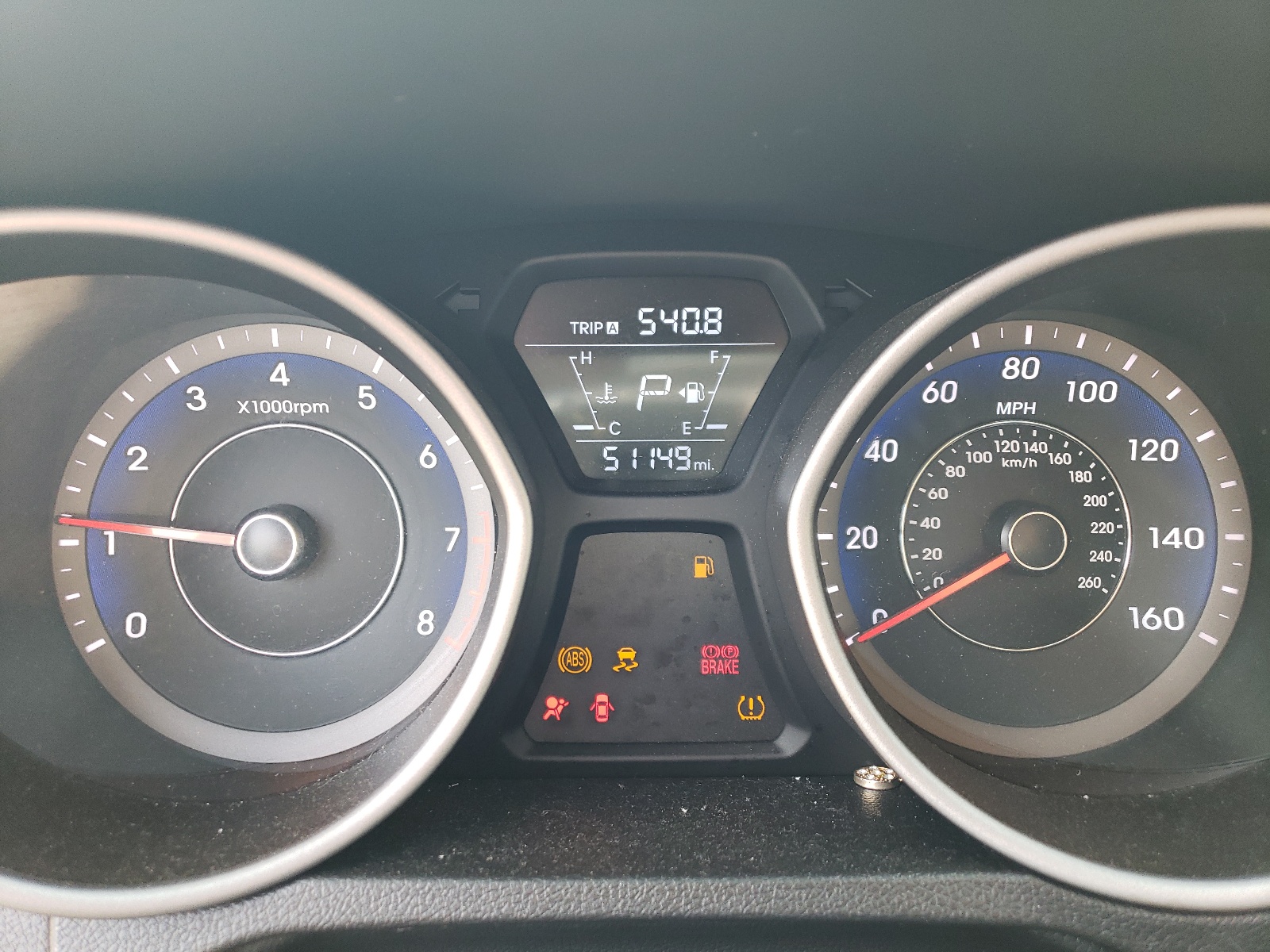 KMHDH4AE6FU393155 2015 Hyundai Elantra Se