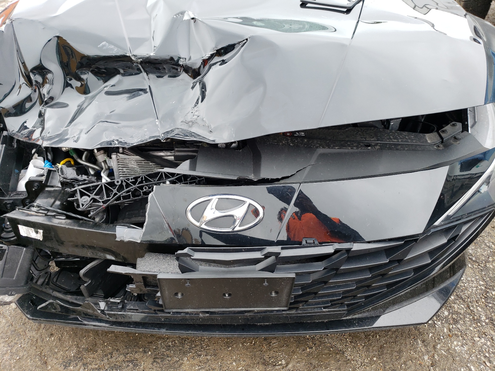 5NPLM4AG5NH083942 2022 Hyundai Elantra Sel