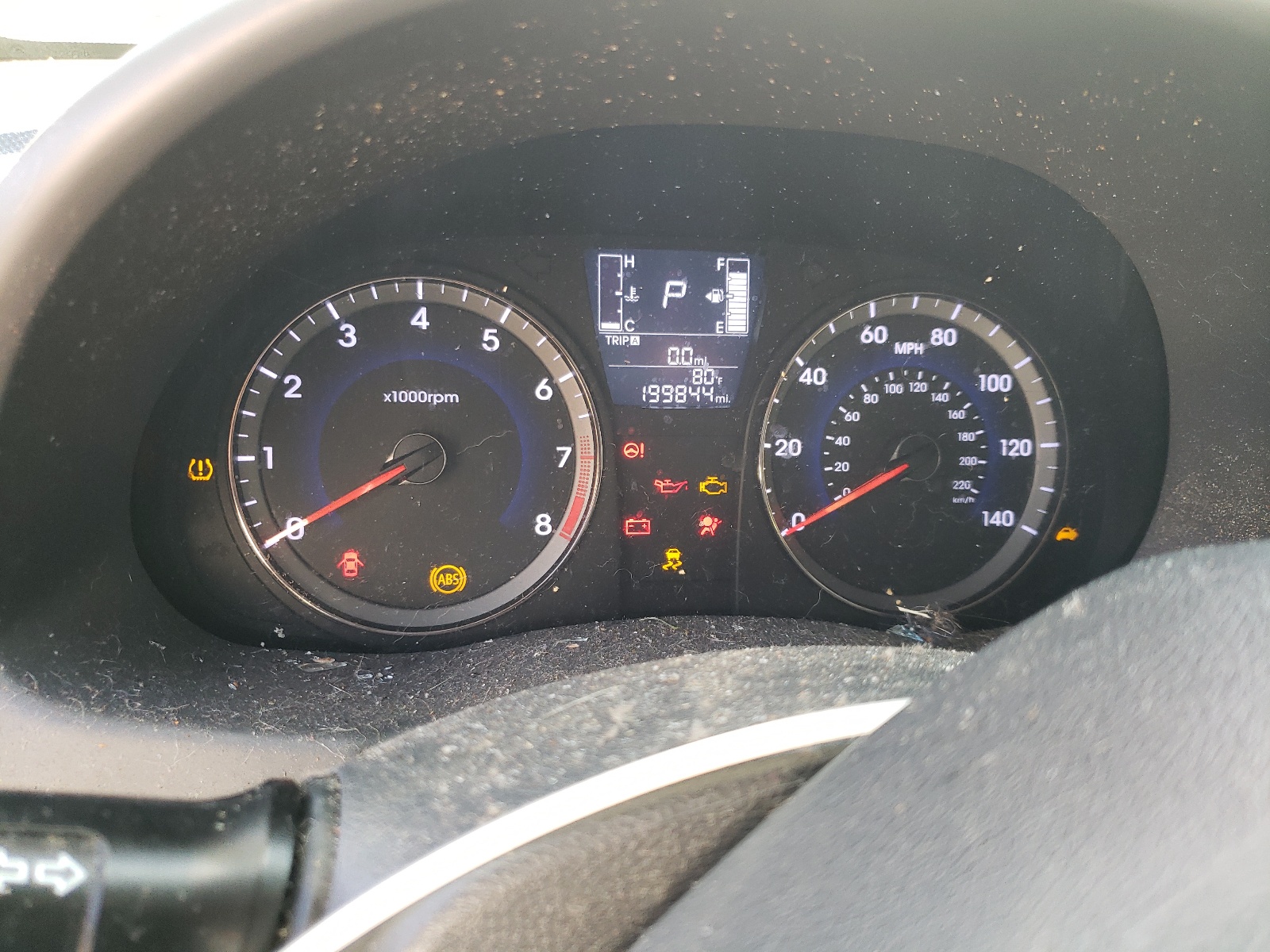 KMHCT4AE7GU106076 2016 Hyundai Accent Se