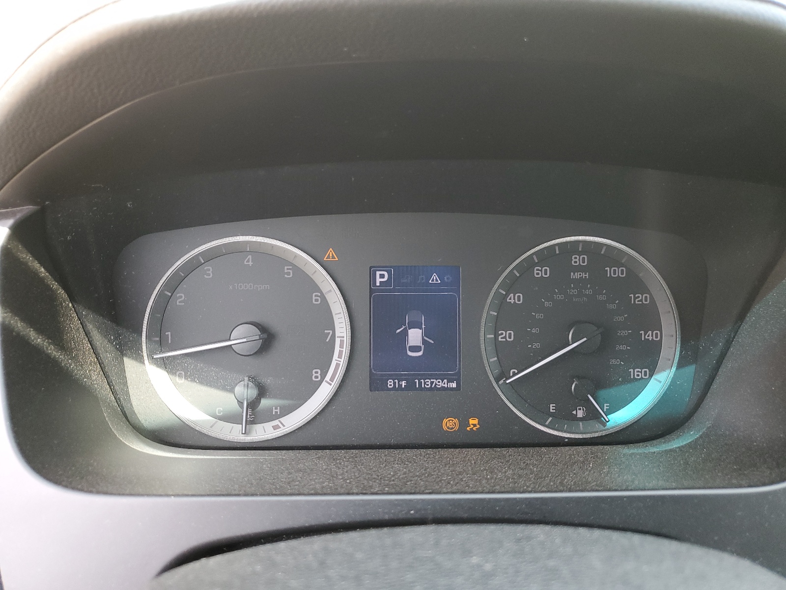 5NPE34AF4GH422924 2016 Hyundai Sonata Sport