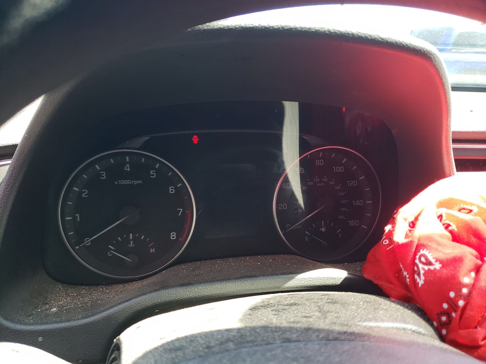 KMHD84LF1HU065635 2017 Hyundai Elantra Se