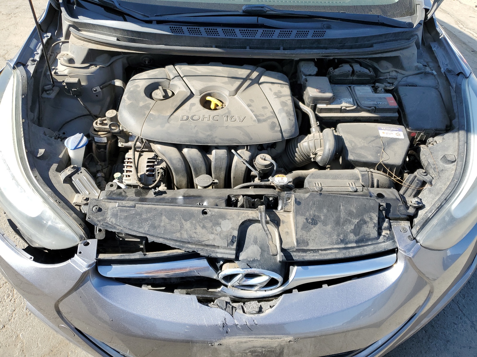 KMHDH4AE3GU531414 2016 Hyundai Elantra Se