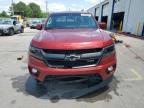 2016 Chevrolet Colorado Z71 for Sale in Montgomery, AL - Front End