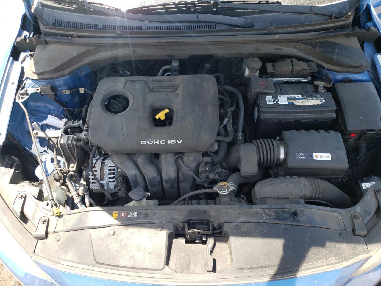 2017 Hyundai Elantra Se VIN: KMHD84LF9HU431549 Lot: 57609585