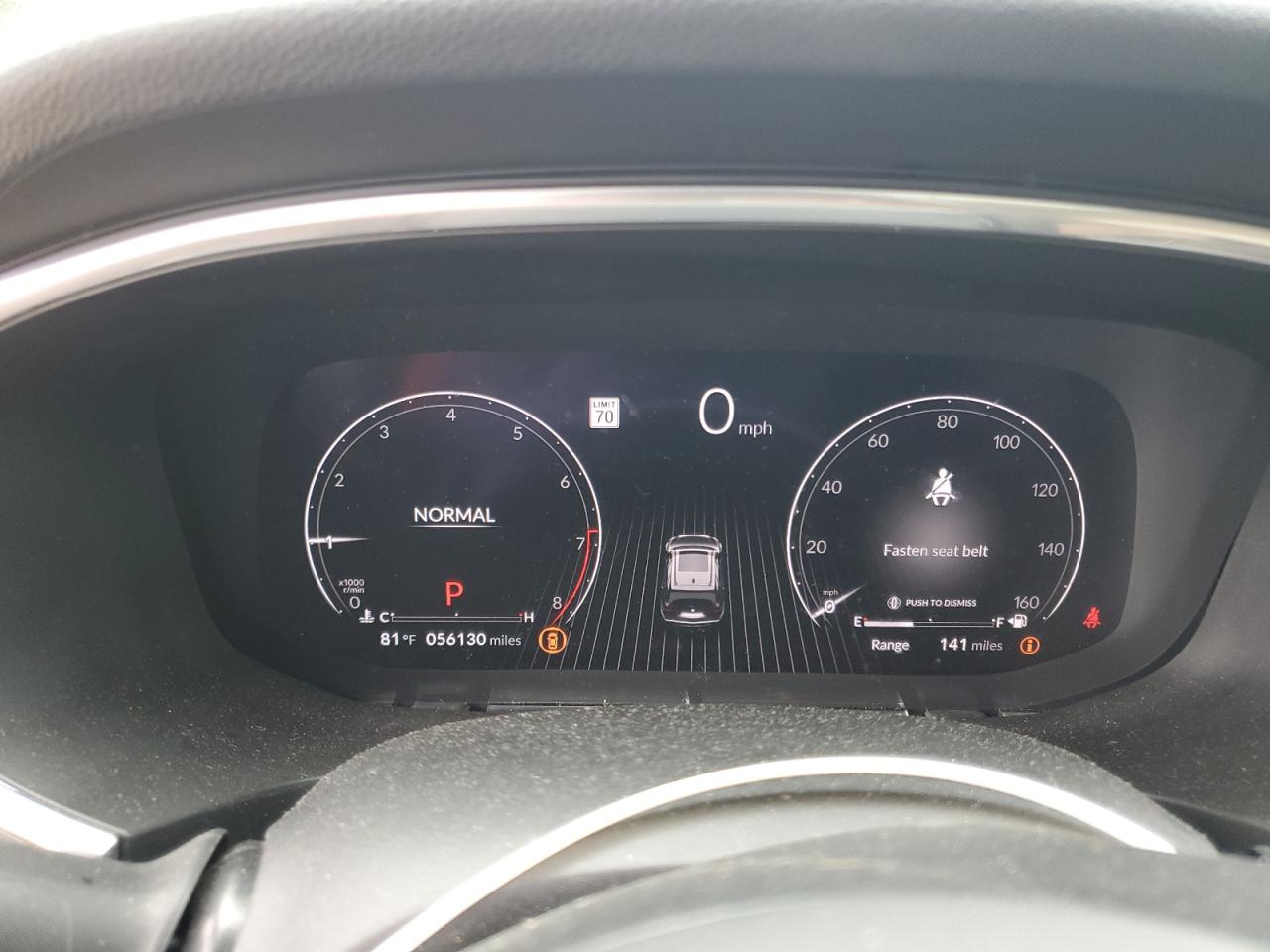 2022 Acura Mdx VIN: 5J8YE1H35NL039117 Lot: 57648865