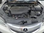 2016 Acura Tlx  for Sale in Hueytown, AL - Top/Roof