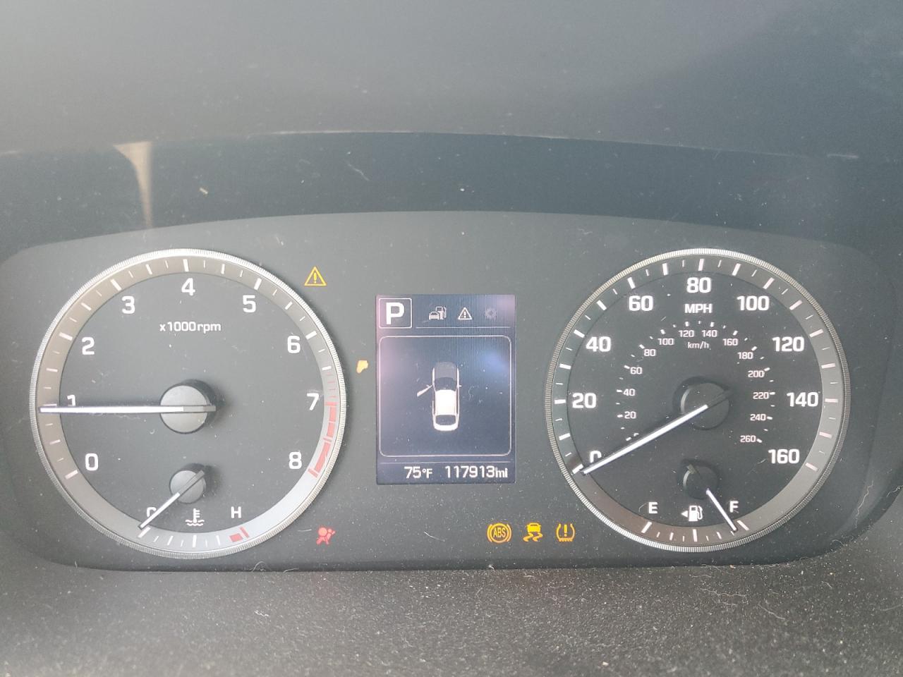 5NPE24AF7GH417171 2016 Hyundai Sonata Se