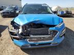 Rocky View County, AB에서 판매 중인 2021 Hyundai Kona Limited   - Front End