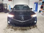 North Billerica, MA에서 판매 중인 2018 Acura Tlx Tech+A - Side