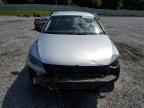 2016 Volkswagen Jetta Se en Venta en Gastonia, NC - All Over
