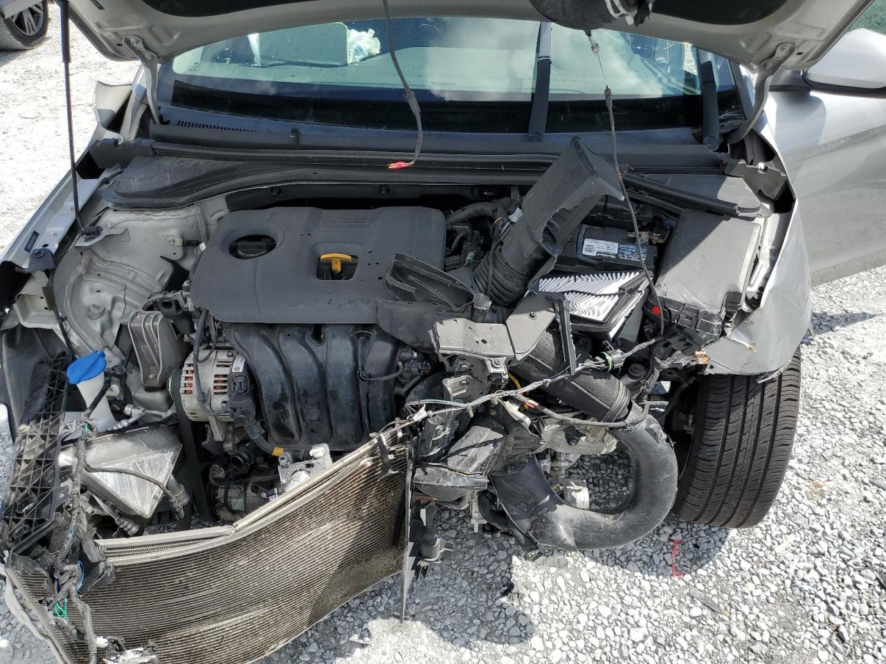 2020 Hyundai Elantra Sel VIN: 5NPD84LF8LH575522 Lot: 56884575