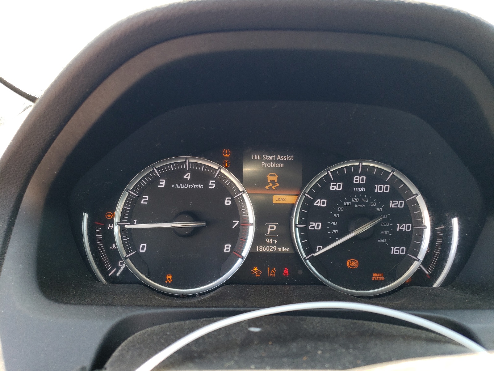 19UUB3F51GA002572 2016 Acura Tlx Tech