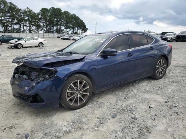 2015 Acura Tlx Tech