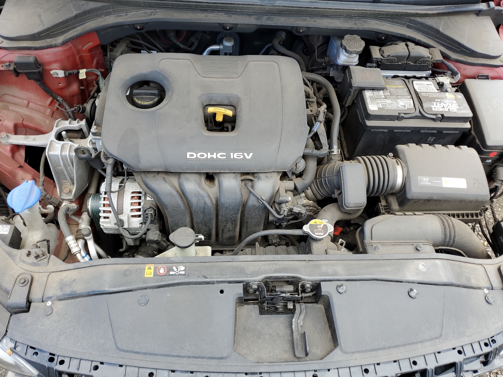 KMHD74LF2HU399224 2017 Hyundai Elantra Se