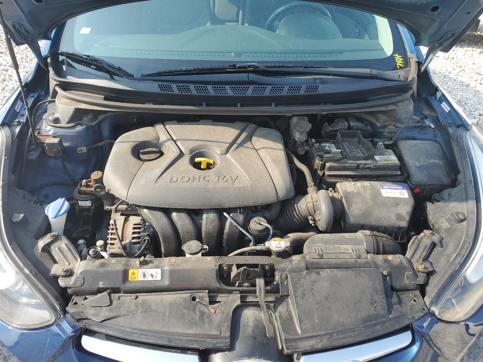 KMHDH4AE6FU387520 2015 Hyundai Elantra Se