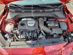 2018 Hyundai Kona Limited for Sale in Louisville, KY - Front End
