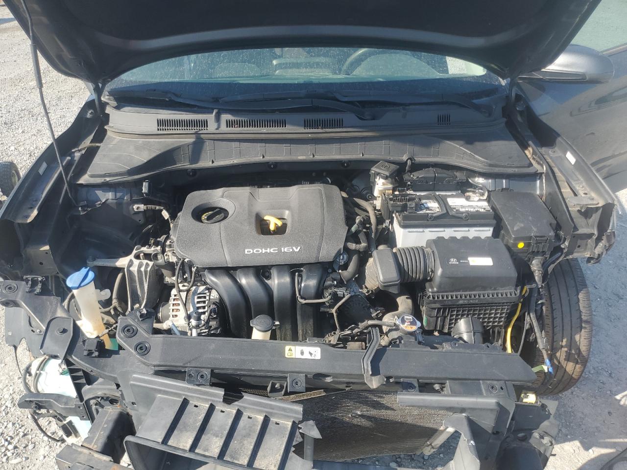 2018 Hyundai Kona Se VIN: KM8K12AA0JU073979 Lot: 62071865