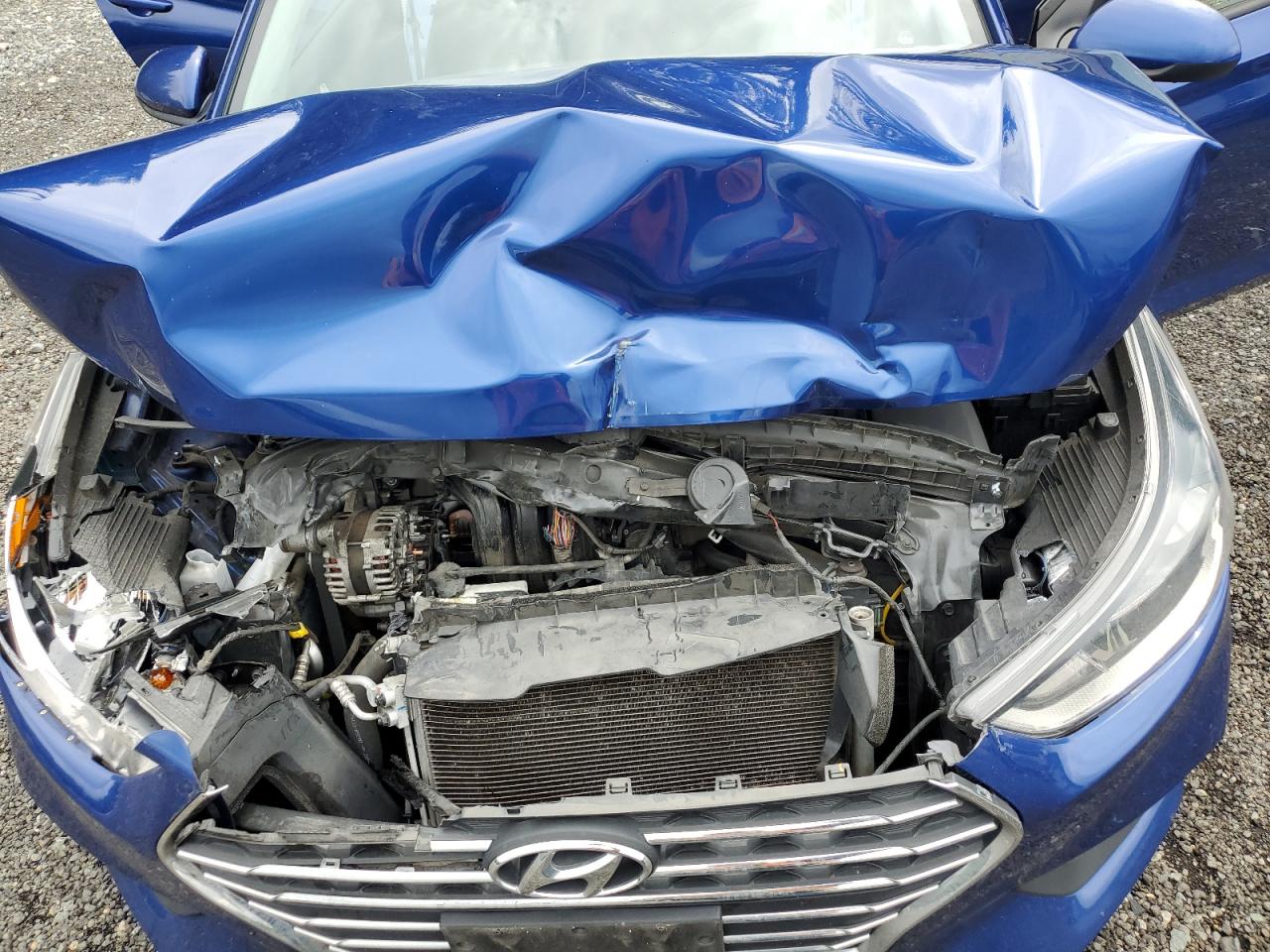 2021 Hyundai Accent Se VIN: 3KPC24A6XME149272 Lot: 62878945
