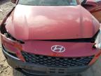 2022 Hyundai Kona Sel for Sale in Baltimore, MD - Front End