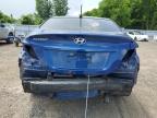 2016 HYUNDAI ACCENT SE   à vendre chez Copart ON - LONDON