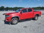 Gastonia, NC에서 판매 중인 2017 Chevrolet Colorado 3.6L - Front End