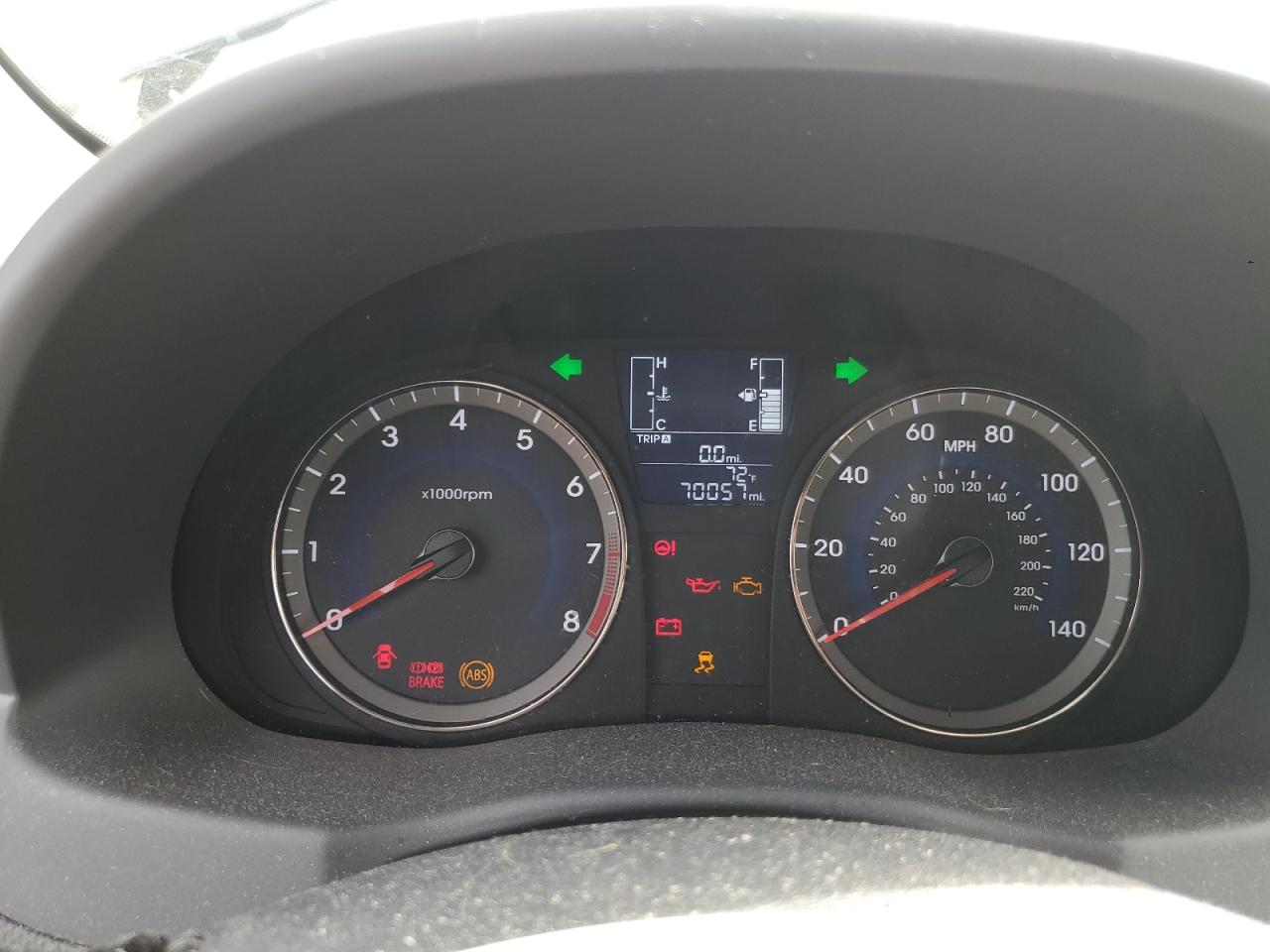 HYUNDAI ACCENT 2015 VIN KMHCT4AE4FU812064 фото 9