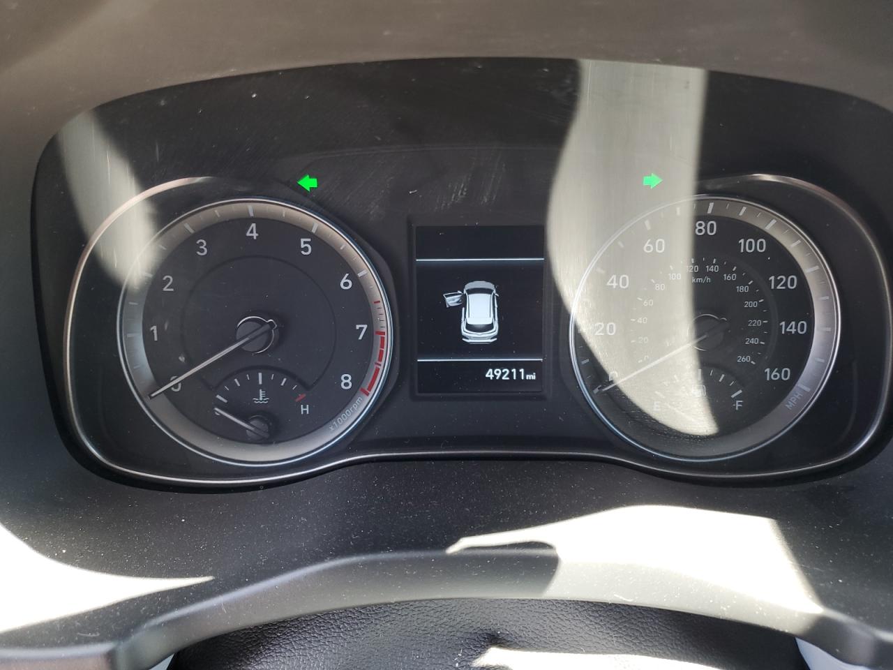 2021 Hyundai Kona Se VIN: KM8K12AA3MU607562 Lot: 61689915