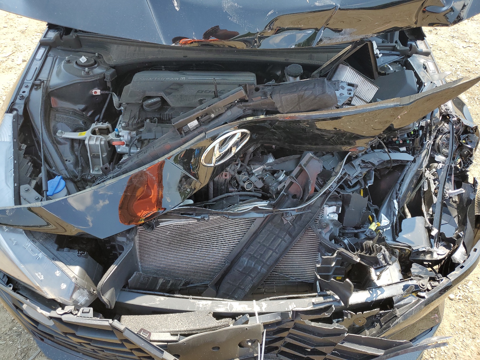 KMHLM4AG2NU315060 2022 Hyundai Elantra Sel