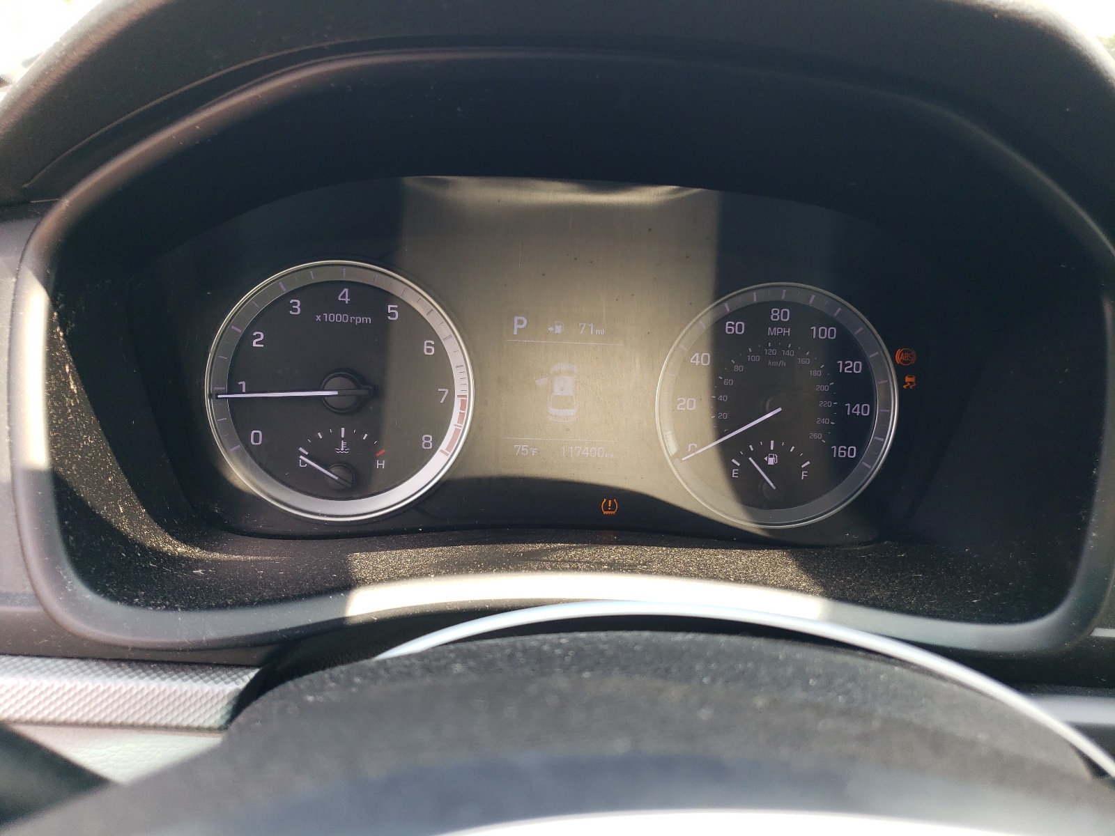 5NPE24AF4JH643949 2018 Hyundai Sonata Se