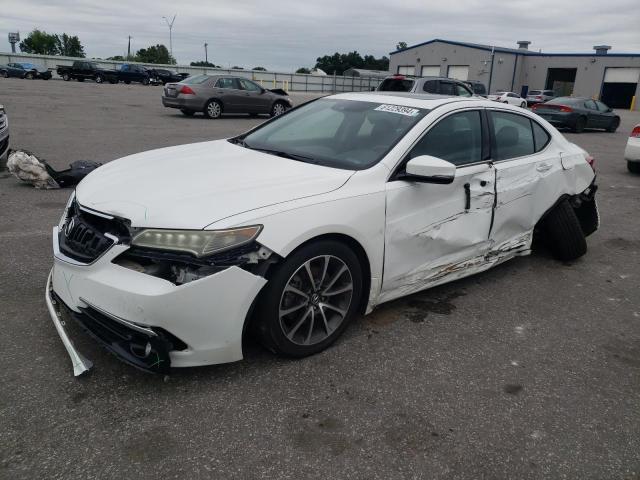 2017 Acura Tlx Advance