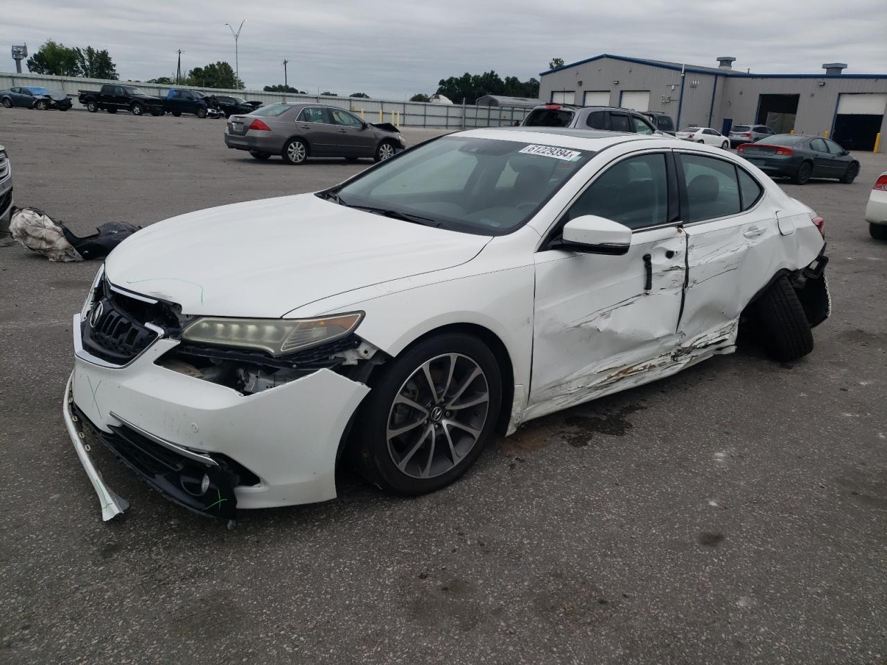 2017 Acura TLX - Image 1