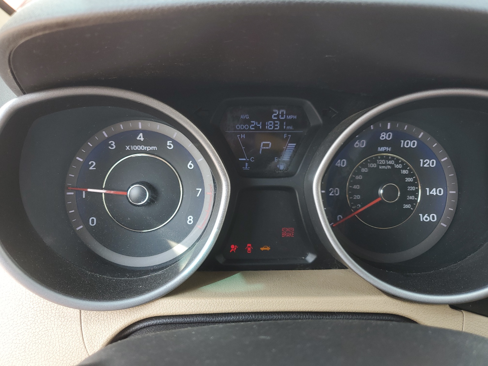 KMHDH4AEXBU113649 2011 Hyundai Elantra Gls