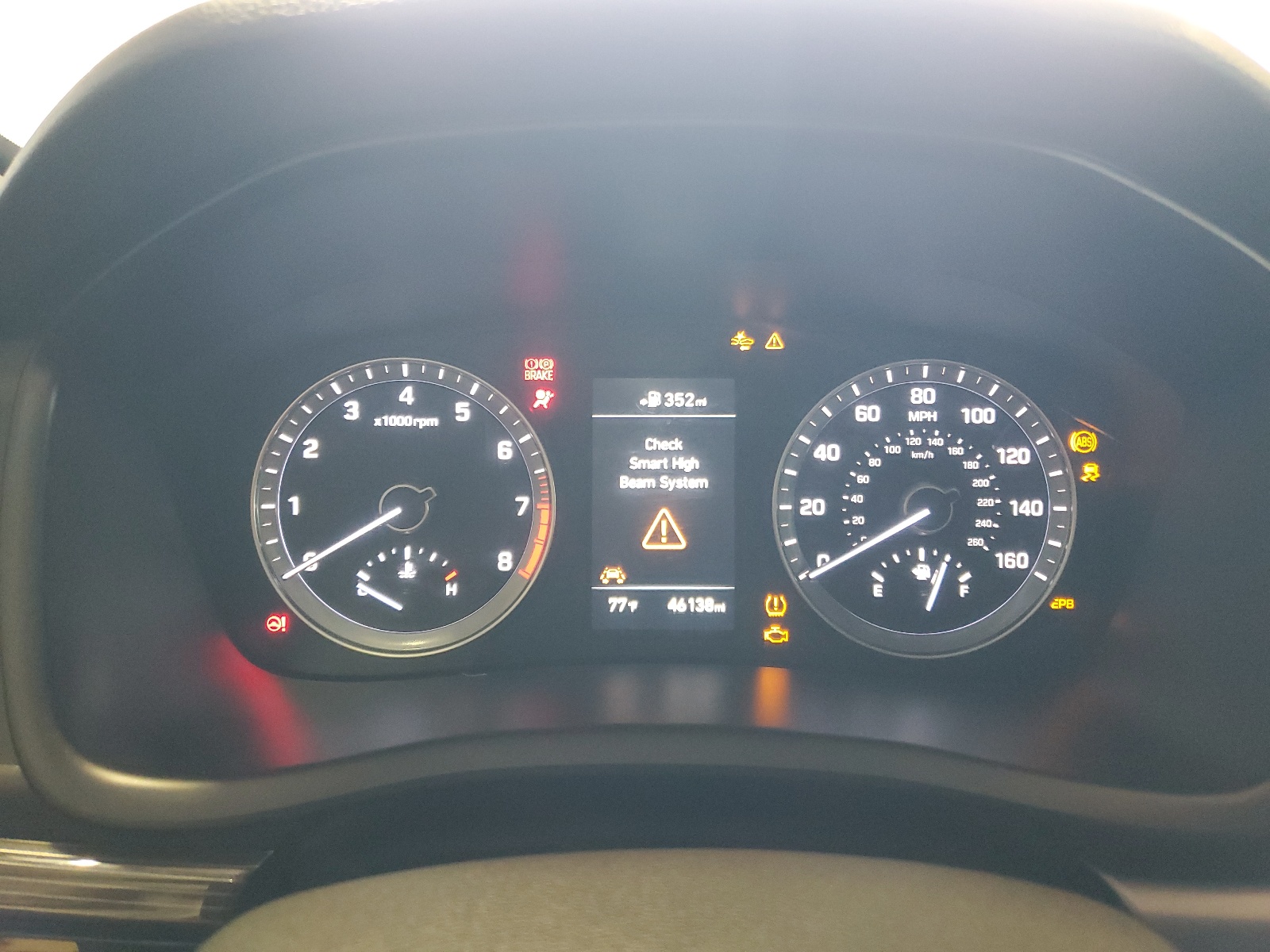 5NPE34AF0JH660888 2018 Hyundai Sonata Sport