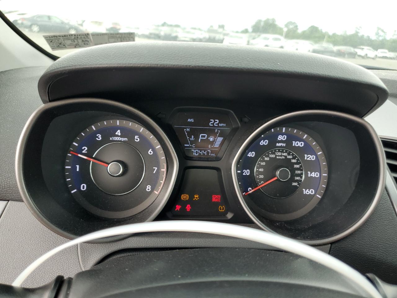 2015 Hyundai Elantra Se VIN: 5NPDH4AE5FH621788 Lot: 65057654