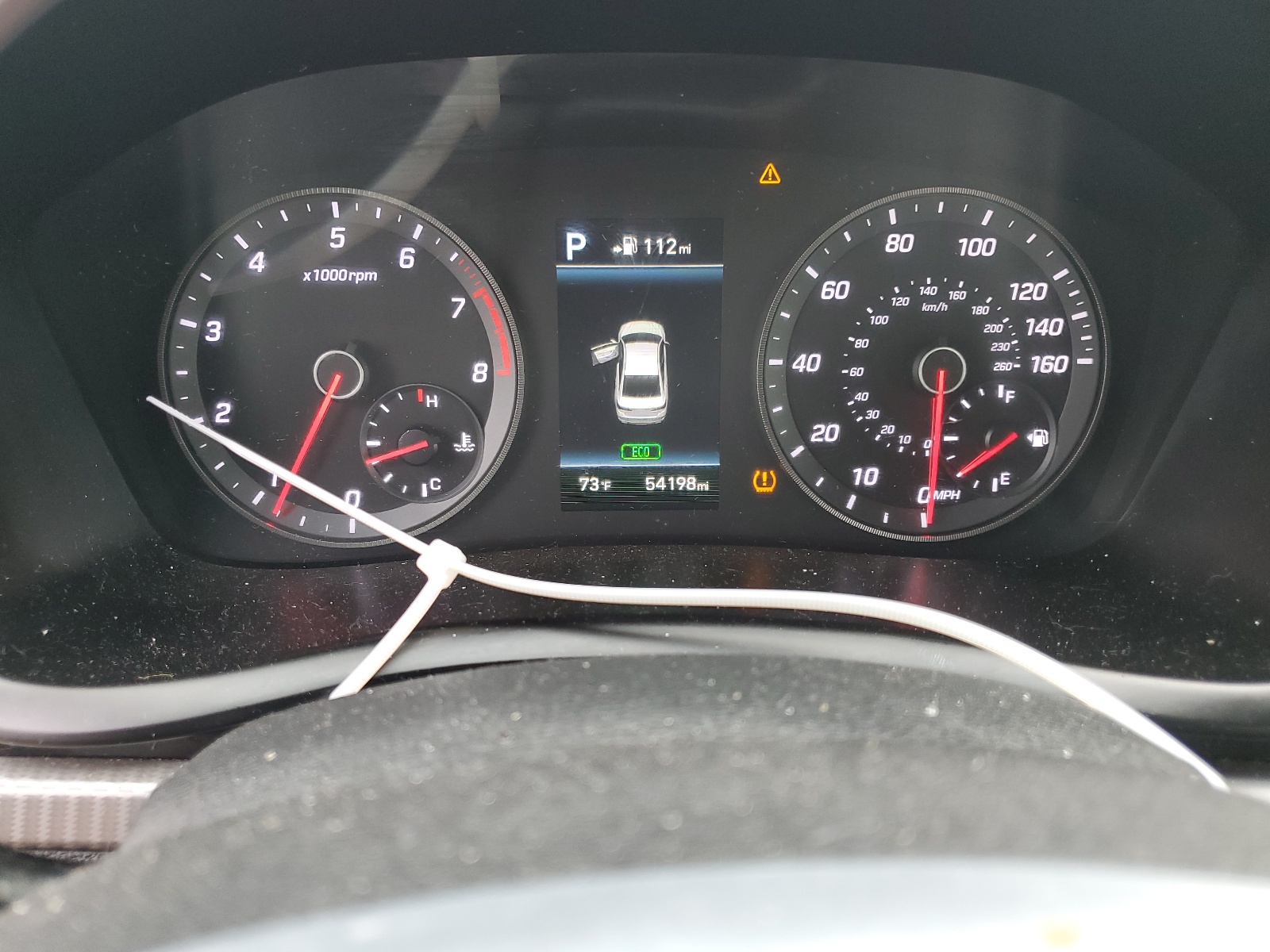 5NPE34AF2JH723750 2018 Hyundai Sonata Sport